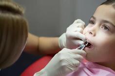Удаление постоянных зубов детям
